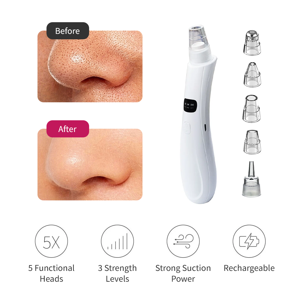 Electric Blackhead Remover — 3 Mode Pore Vacuum Cleanser